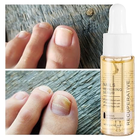 7 Days Nail Growth - Strengthening Serum – 20 ml
